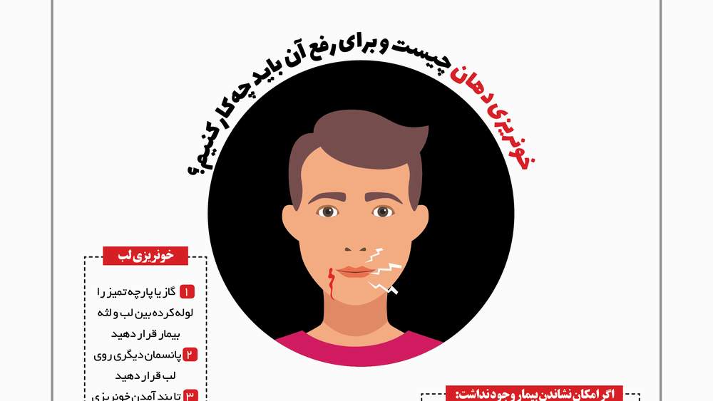 خونریزی دهان چیست و برای رفع آن باید چه‌کار کنیم؟/ اینفوگرافیک